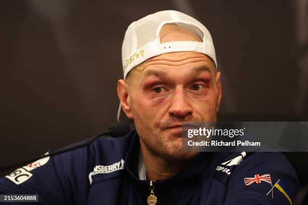 Tyson Fury